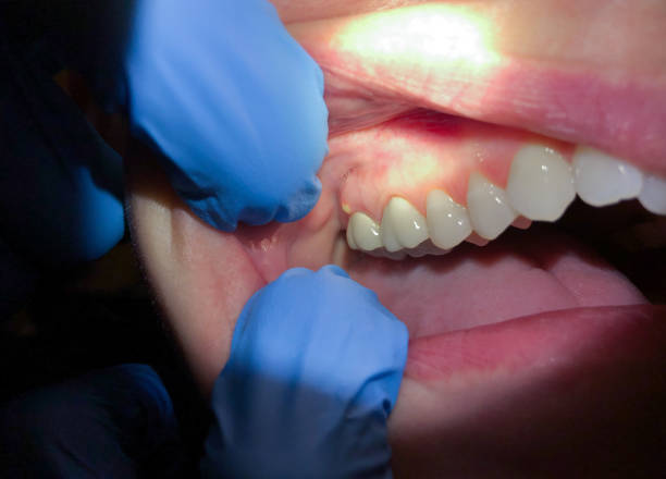 Best Emergency Treatment for Jaw Pain or Injury in Talahi Island, GA